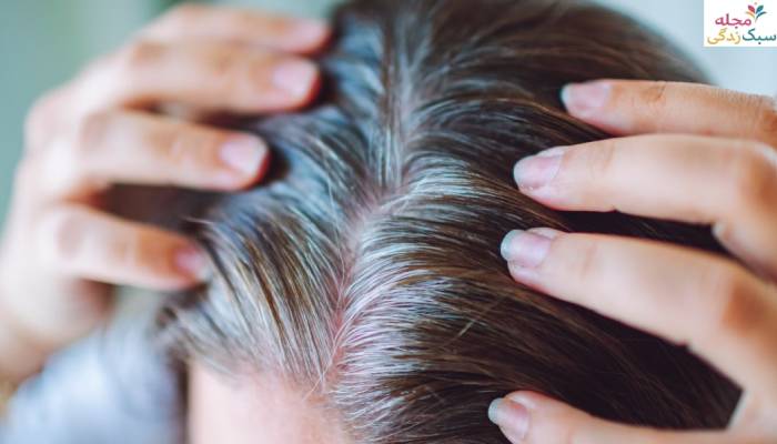 برای جلوگیری از سفید شدن مو چه بخوریم
