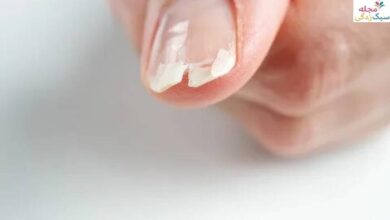 علت شکستن ناخن ها چیست؟! چرا ناخن ها شکننده می شوند