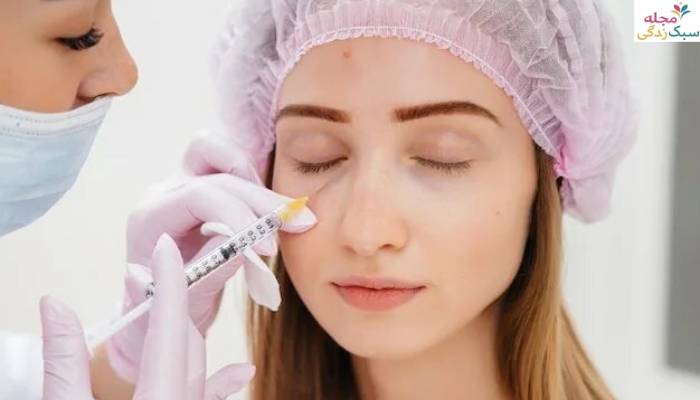 فیلر زیر چشم برای چه کسانی مناسب است؟