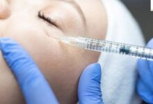 چه زمانی فیلر زیر چشم بزنیم