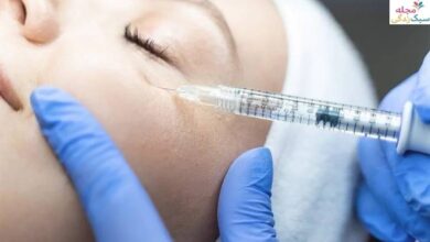 چه زمانی فیلر زیر چشم بزنیم